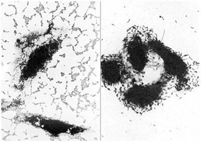 Are Escherichia coli Pathotypes Still Relevant in the Era of Whole-Genome Sequencing?